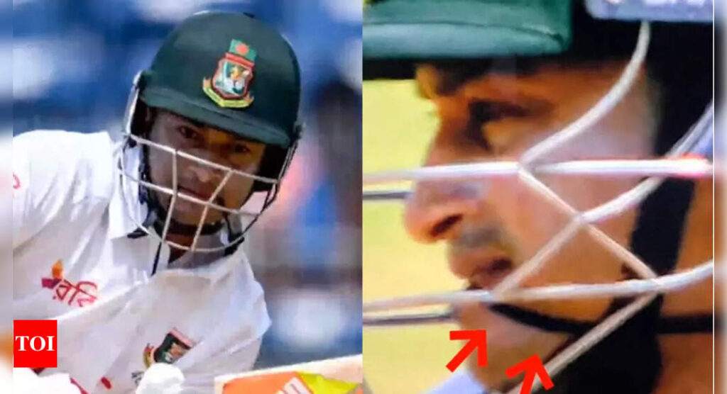 EXPLAINED: Why Bangladesh batsman Shakib Al Hasan is holding a band between his teeth while batting | Cricket News